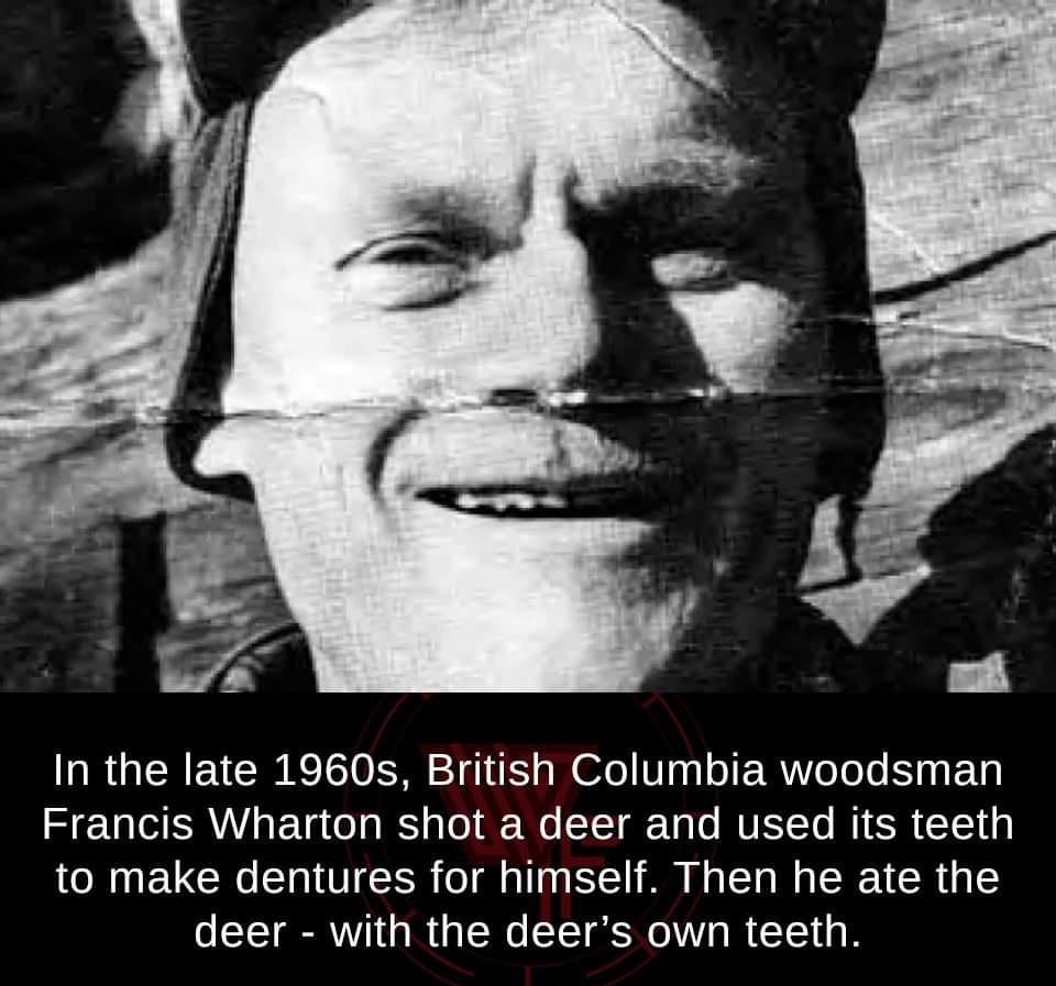 In the late 1960s British Columbia woodsman S TSV g T o W o1 F Wo YT T o MUEYTo MI SR L110 R UG CIITTCEIR I IS A R G deer with the deers own teeth Photo courtesy of Museum of Health Care via chcca weird factsorg