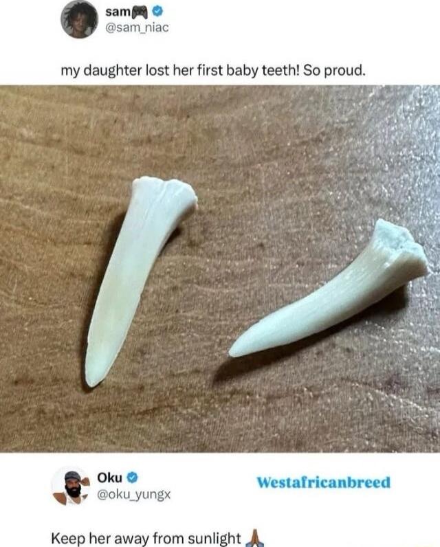 my daughter lost her first baby teeth! So proud.
Keep her away from sunlight 🙏