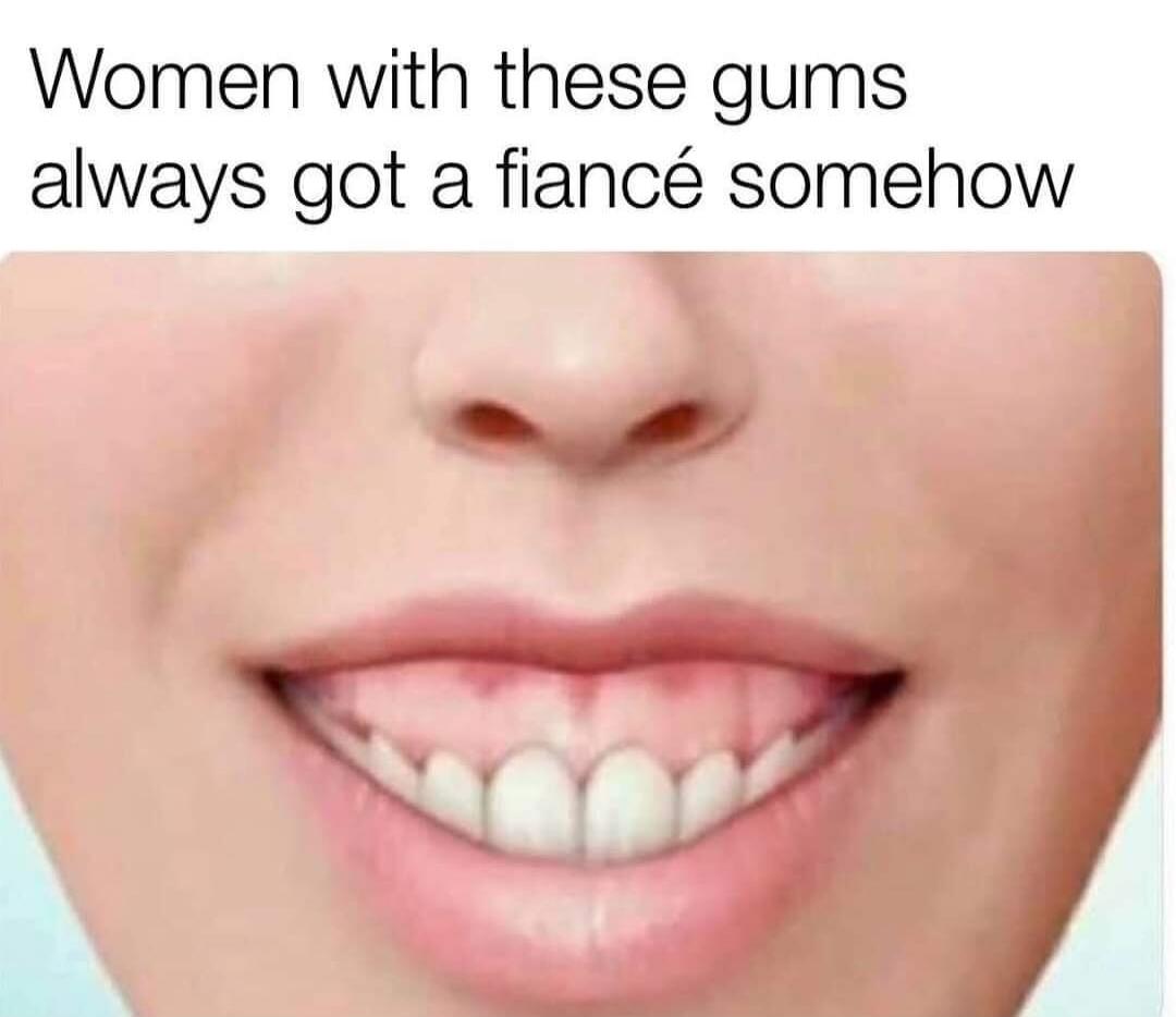 Women with these gums always got a fiancé somehow