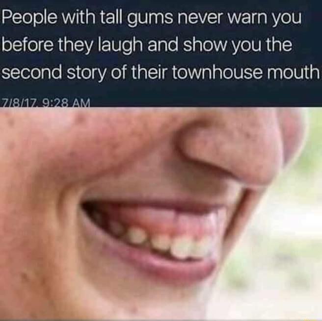 People with tall gums never warn you before they laugh and show you the second story of their townhouse mouth