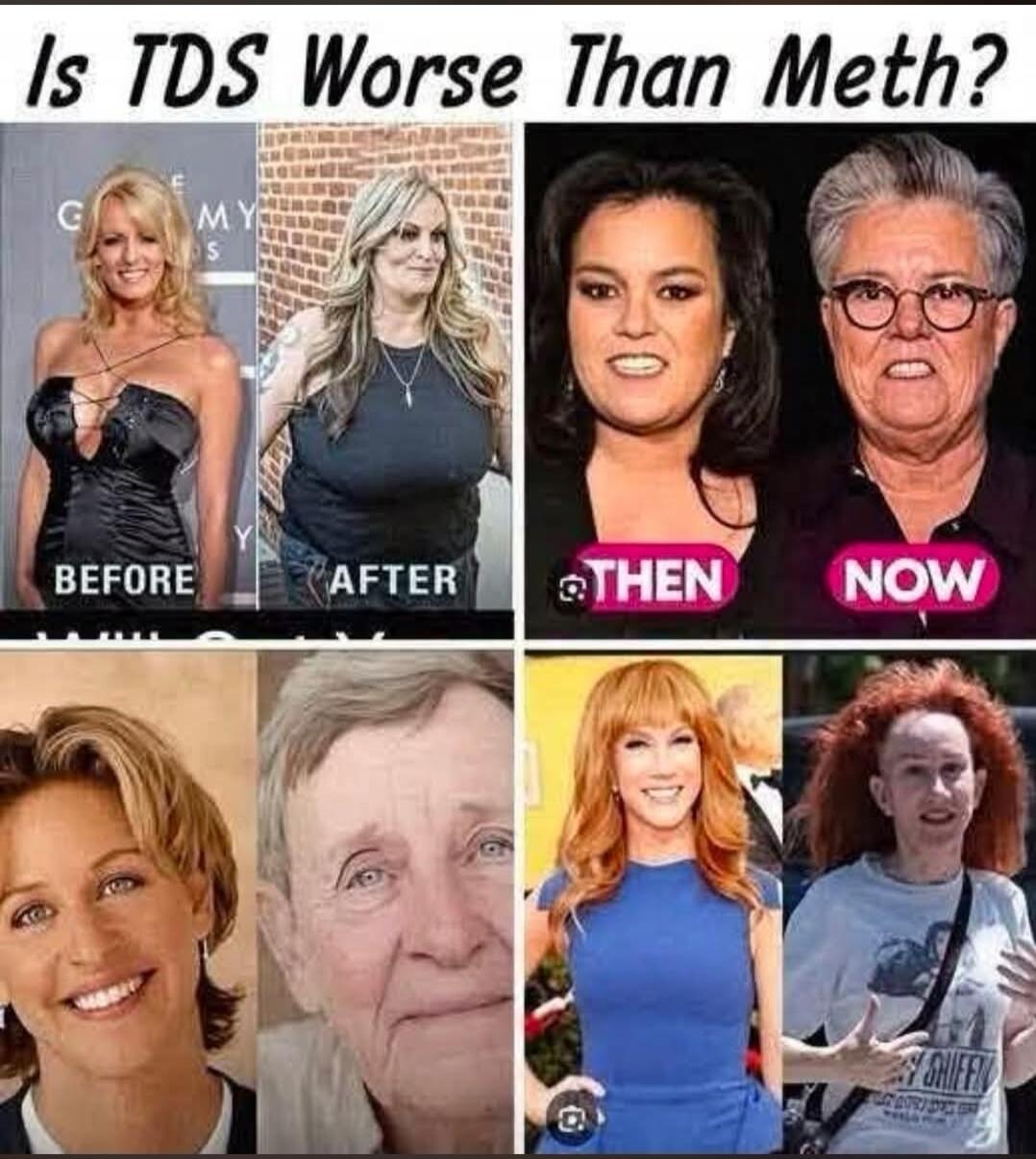 Is TDS Worse Than Meth? BEFORE AFTER THEN NOW