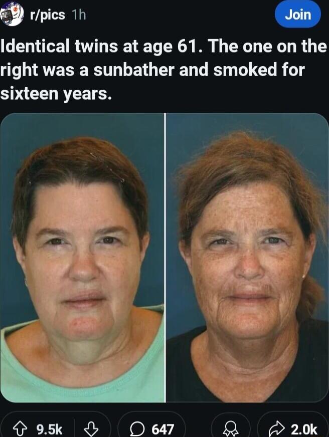 Ij rpics 1h Identical twins at age 61 The one on the L IRTERER L EN G L R TG R e SACEL RTET N