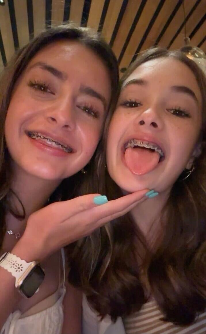 Two girls posing with braces, smiling at the camera.
