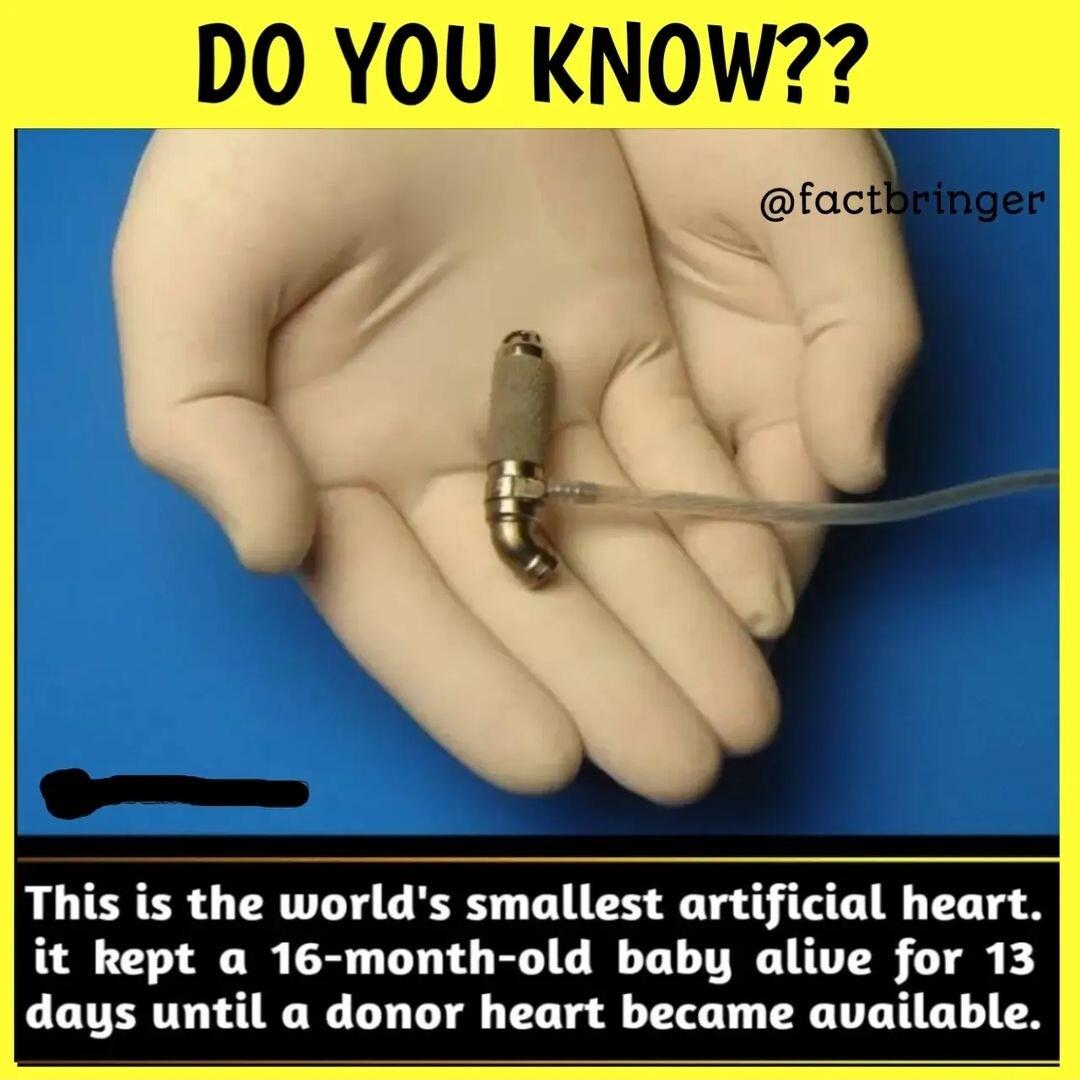 This is the worlds smallest artificial heart it kept a 16 month old baby alive for 13 days until a donor heart became available