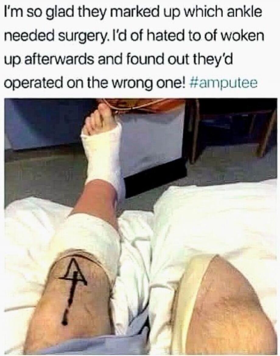 I'm so glad they marked up which ankle needed surgery. I'd of hated to of woken up afterwards and found out they'd operated on the wrong one! #amputee