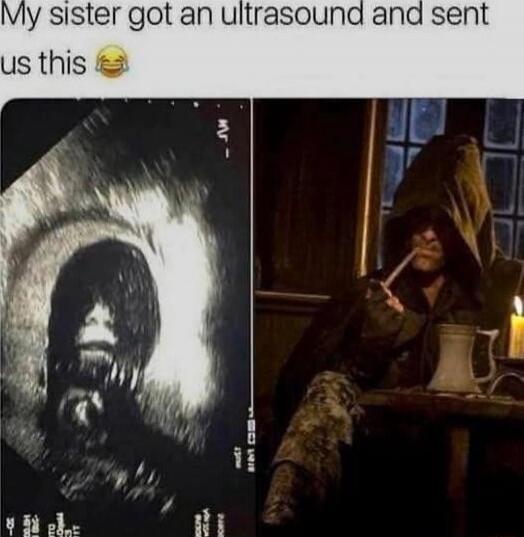 My sister got an ultrasound and sent us this 😂