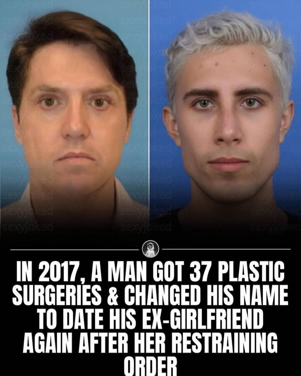IN 2017, A MAN GOT 37 PLASTIC SURGIERIES & CHANGED HIS NAME TO DATE HIS EX-GIRLFRIEND AGAIN AFTER HER RESTRAINING ORDER
