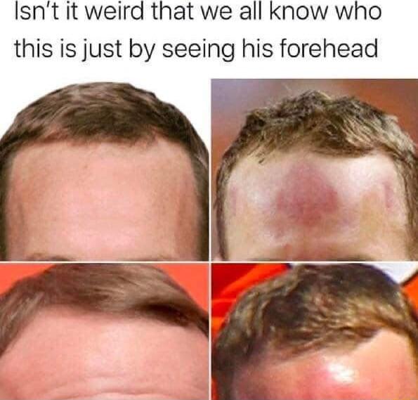 Isnt it weird that we all know who this is just by seeing his forehead