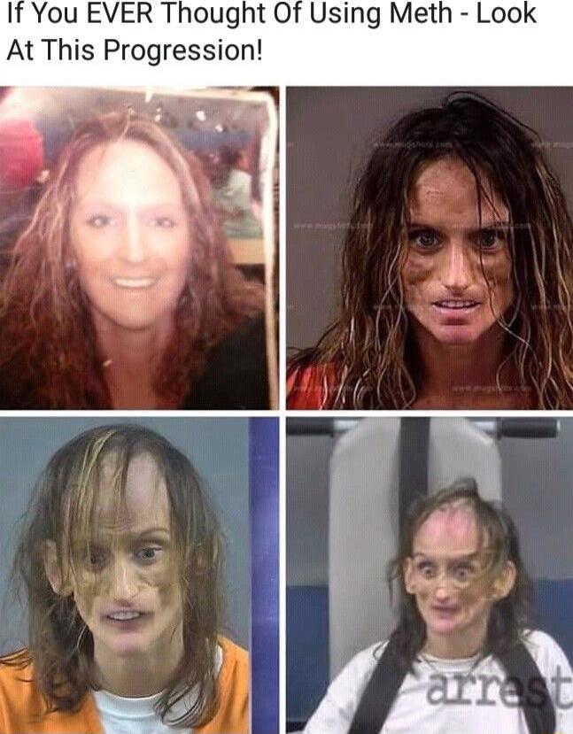 It You EVER Thought Of Using Meth Look At This Progression