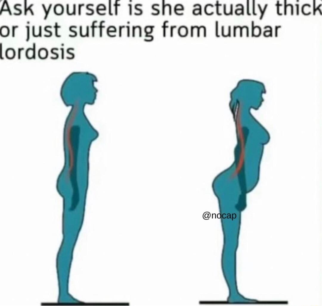ASK yourselr 1s she actually thick or just suffering from lumbar lordosis n
