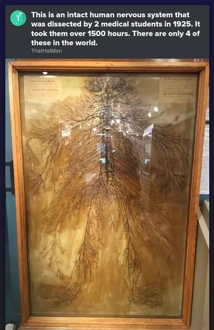 This is an intact human nervous system that was dissected by 2 medical students in 1925 It took them over 1500 hours There are only 4 of these in the world ThatHatMan