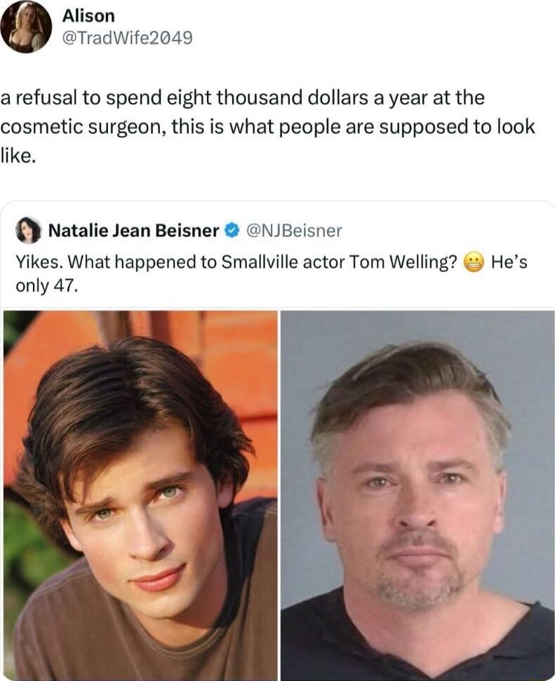 Alison TradWife2049 a refusal to spend eight thousand dollars a year at the cosmetic surgeon this is what people are supposed to look ike O na Yikes What happened to Smallville actor Tom Welling Hes only 47 y ie Jean Beisner NJBeisner