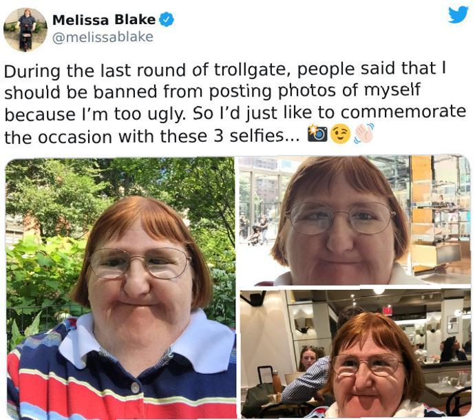 Melissa Blake L 4 Y melissablake During the last round of trollgate people said that should be banned from posting photos of myself because Im too ugly So Id just like to commemorate the occasion with these 3 selfies R A