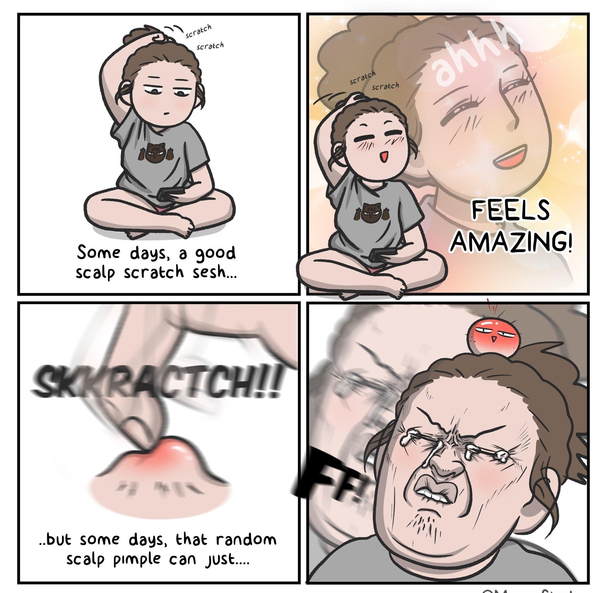 but some days that random scalp pimple can just
