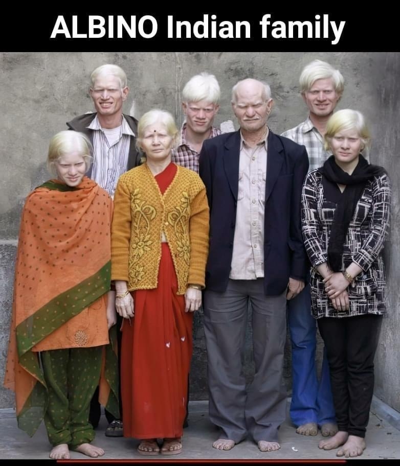 ALBINO Indian family TN