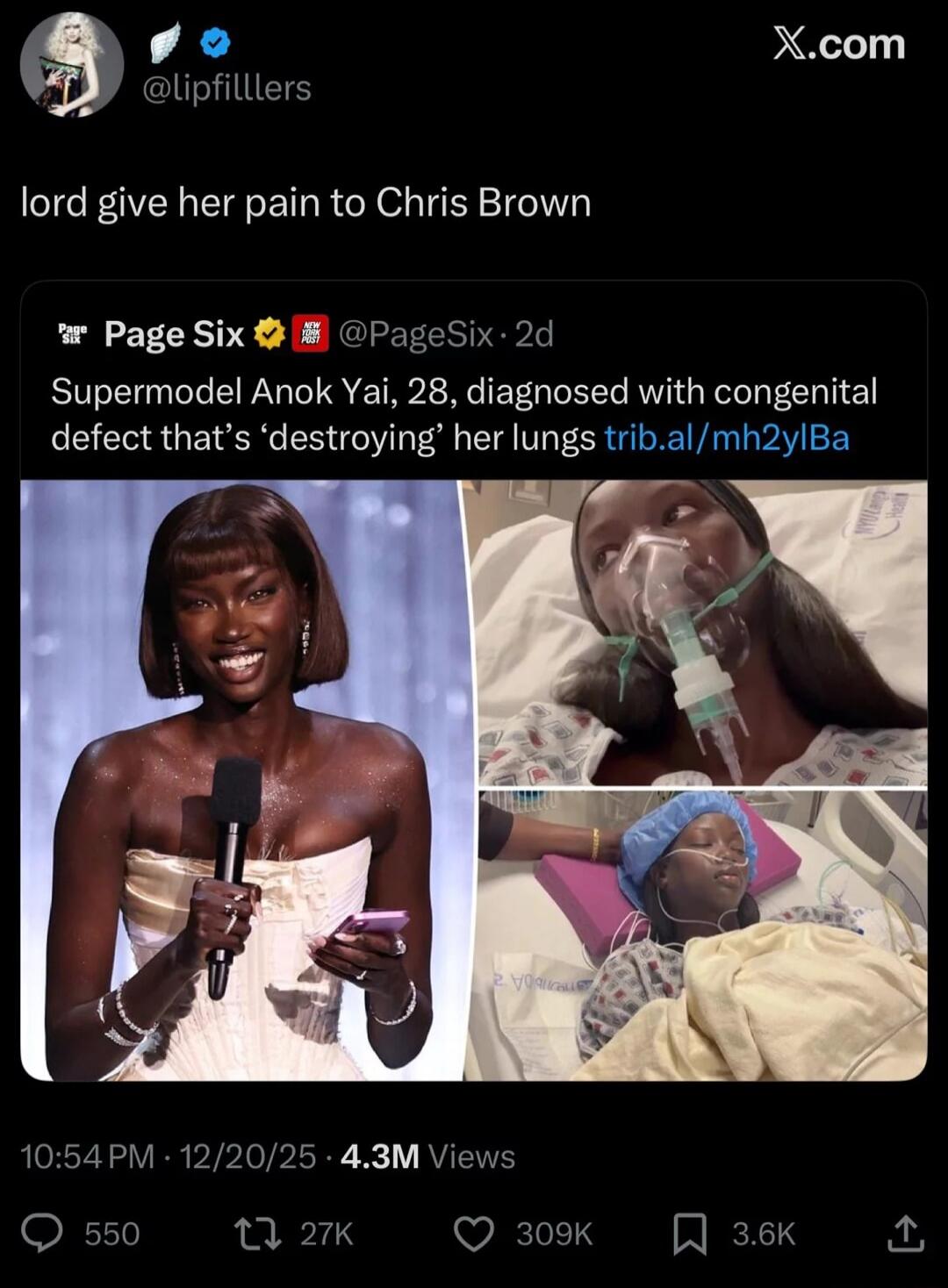 lord give her pain to Chris Brown Supermodel Anok Yai, 28, diagnosed with congenital defect that's 'destroying' her lungs
