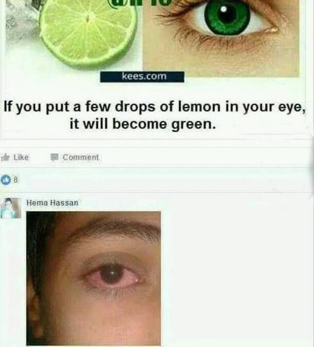 If you put a few drops of lemon in your eye it will become green y Like Comment O A Hema Hassan
