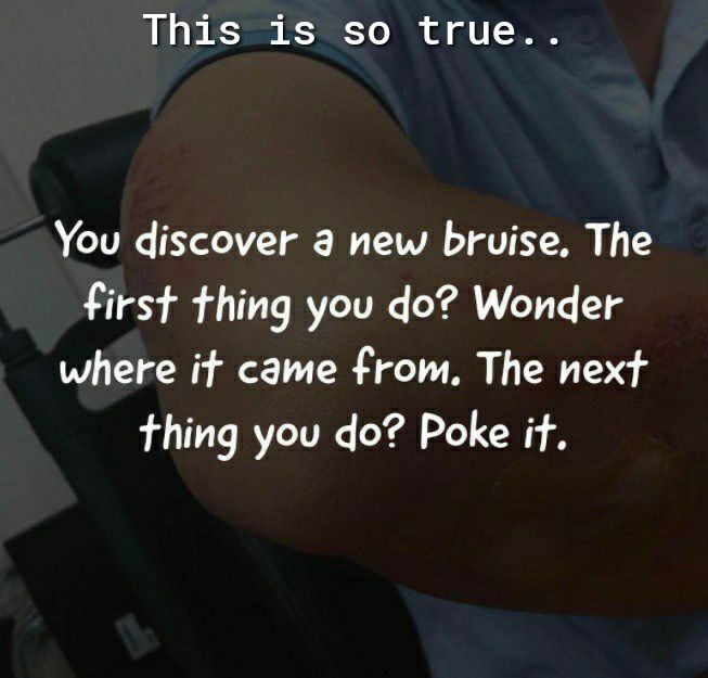 This is so true You discover a new bruise The first thing you do Wonder where it came from The next thing you do Poke it