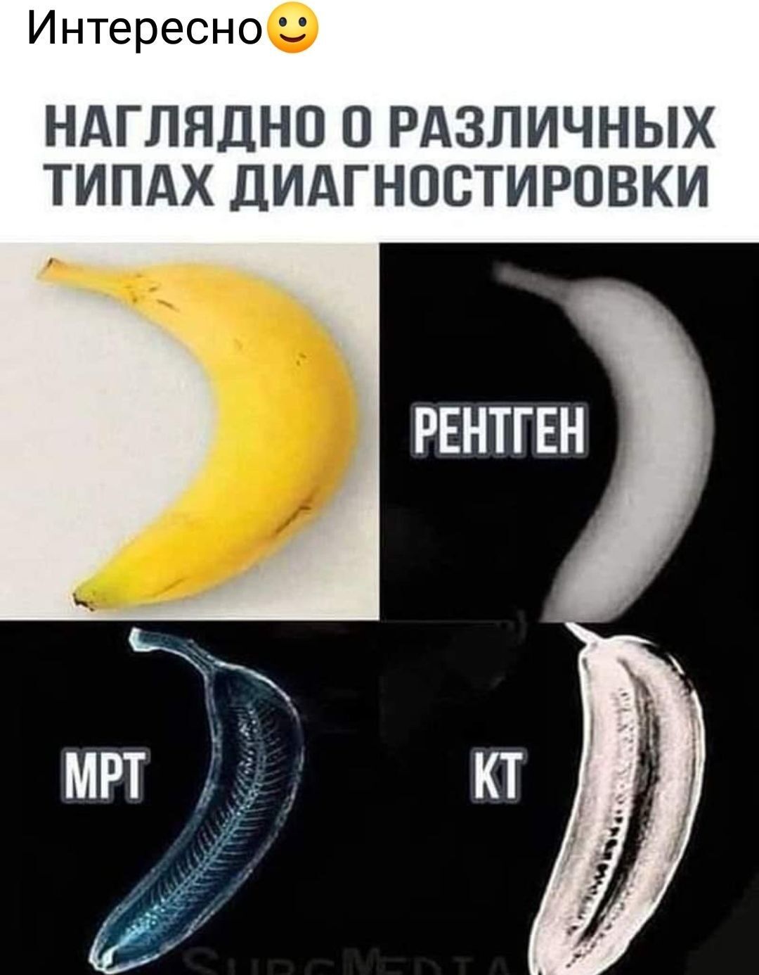 Интересно НАГЛЯДНО О РАЗЛИЧНЫХ ТИПАХ ДИАГНОСТИРОВКИ РЕНТГЕН