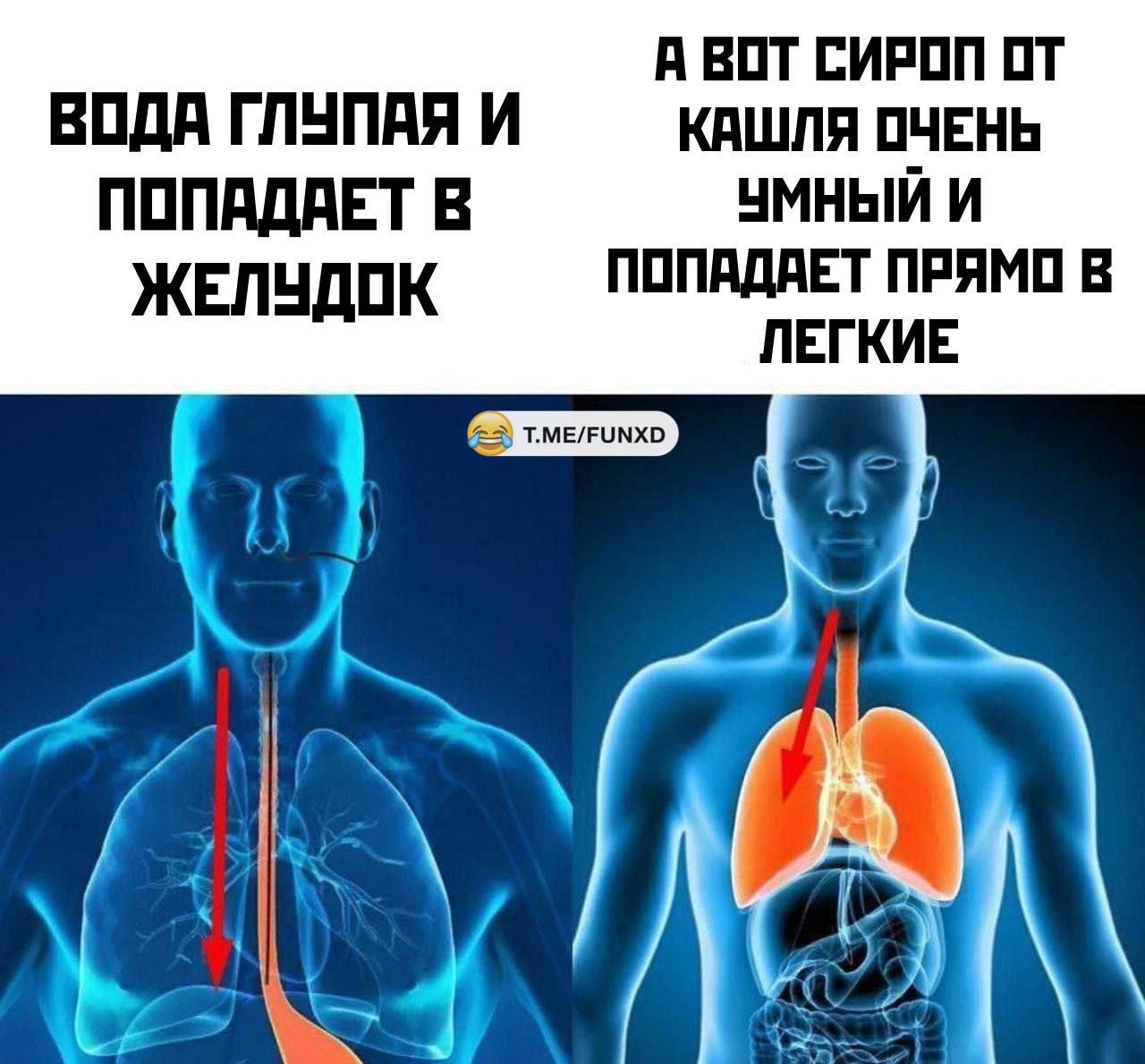 А ВОТ СИРОП ОТ ВОДА ГЛУПАЯ И КАШЛЯ ОЧЕНЬ ПОПАДАЕТ В ЧУМНЫЙ И ЖЕЛУДОК ПОПАДАЕТ ПРЯМО В ЛЕГКИЕ