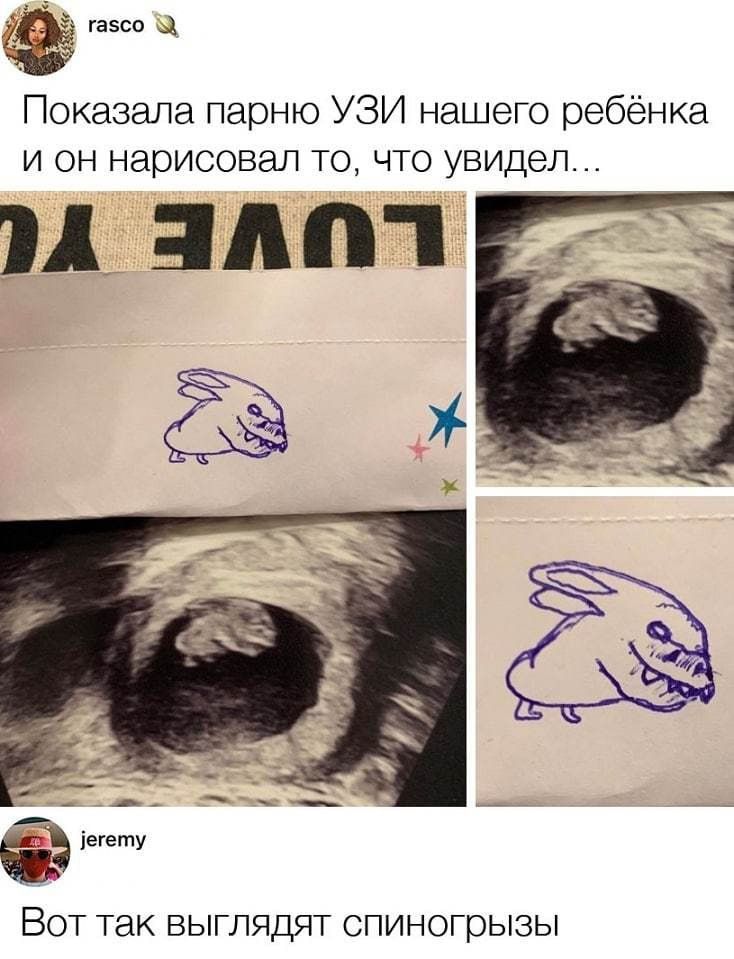 Й ь4 Показала парню УЗИ нашего ребёнка и он нарисовал то что увидел Вот так ВЫГЛЯДдЯТ СПИНОгГрызы