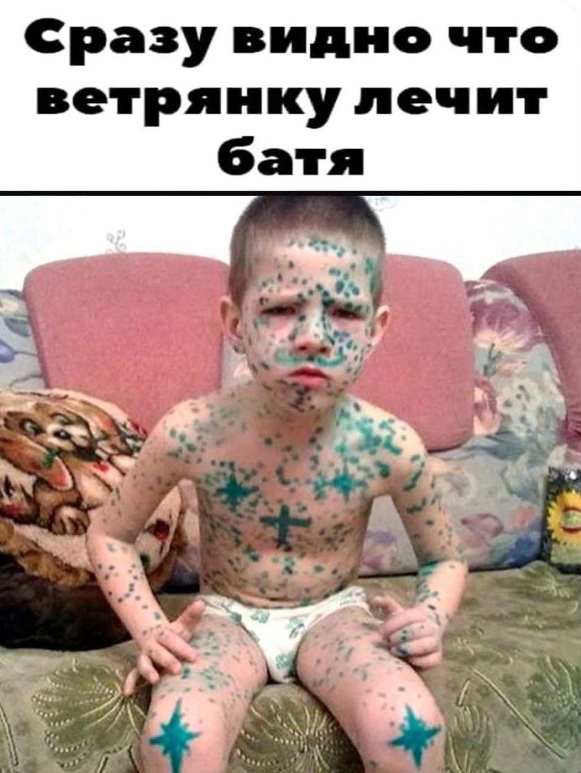 Сразу видно что ветрянку лечит батя иа _ ы