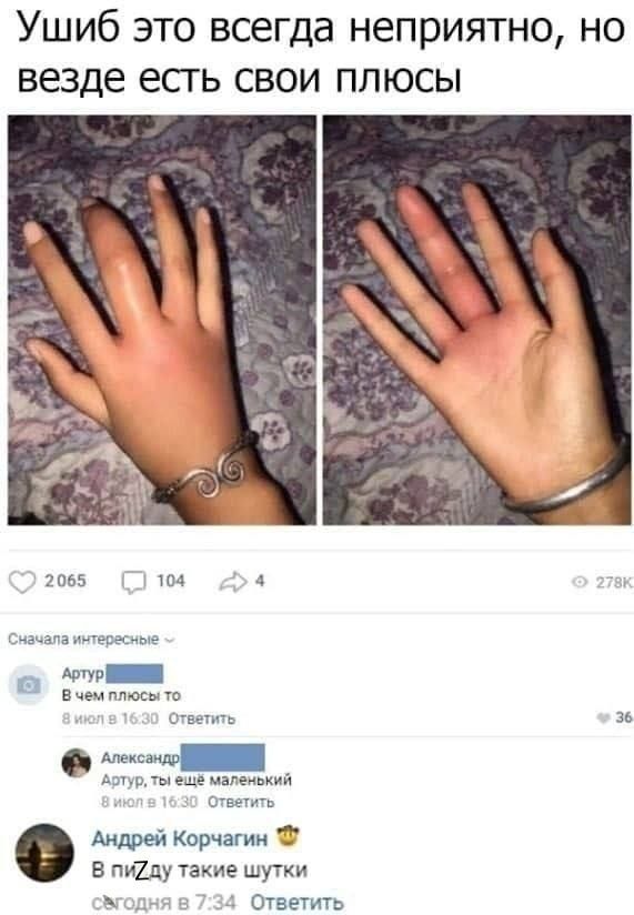 Ушиб это всегда неприятно, но везде есть свои плюсы

А ещё в комментариях:
Артур, В чем плюсы то
Артур, ты ещё маленький
Андрей Корчагин В пизду такие шутки