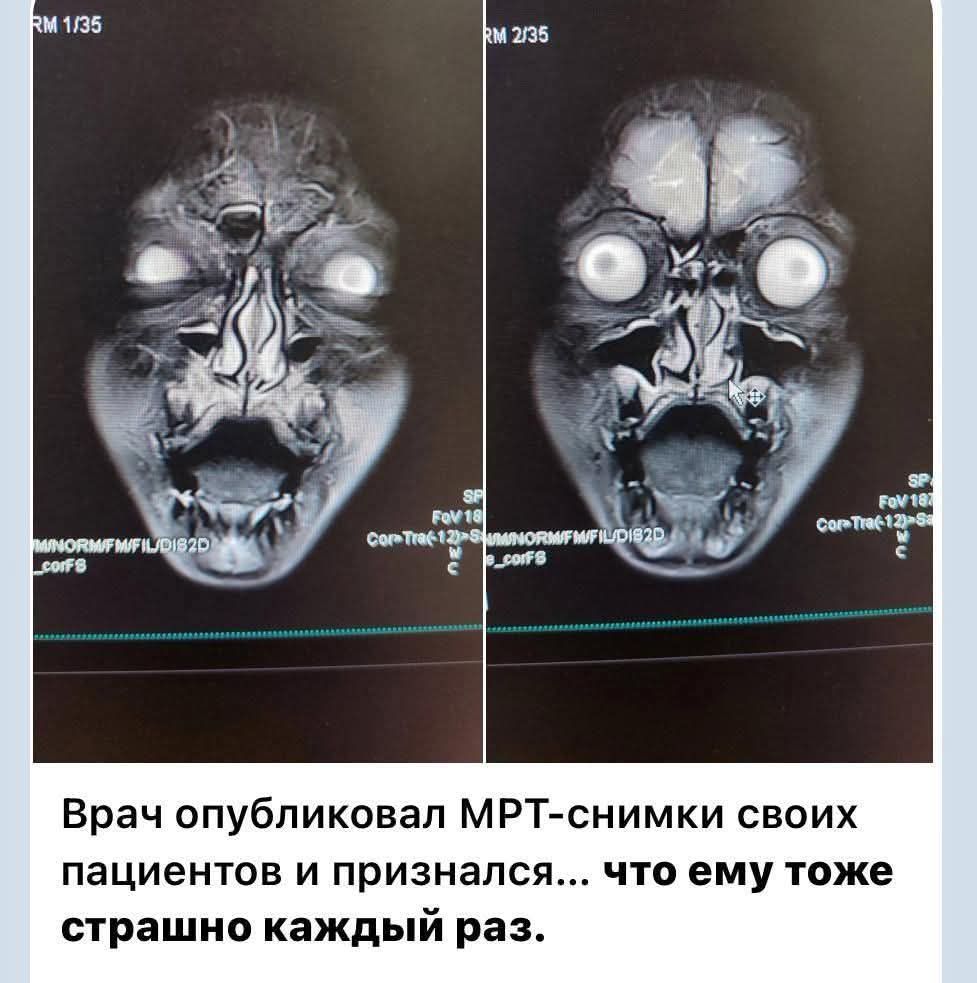 Врач опубликовал МРТ-снимки своих пациентов и признался... что ему тоже страшно каждый раз.