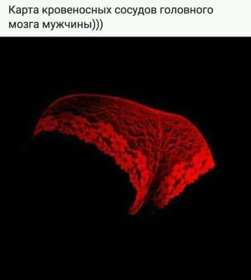 Карта кровеносных сосудов головного мозга мужчины)))