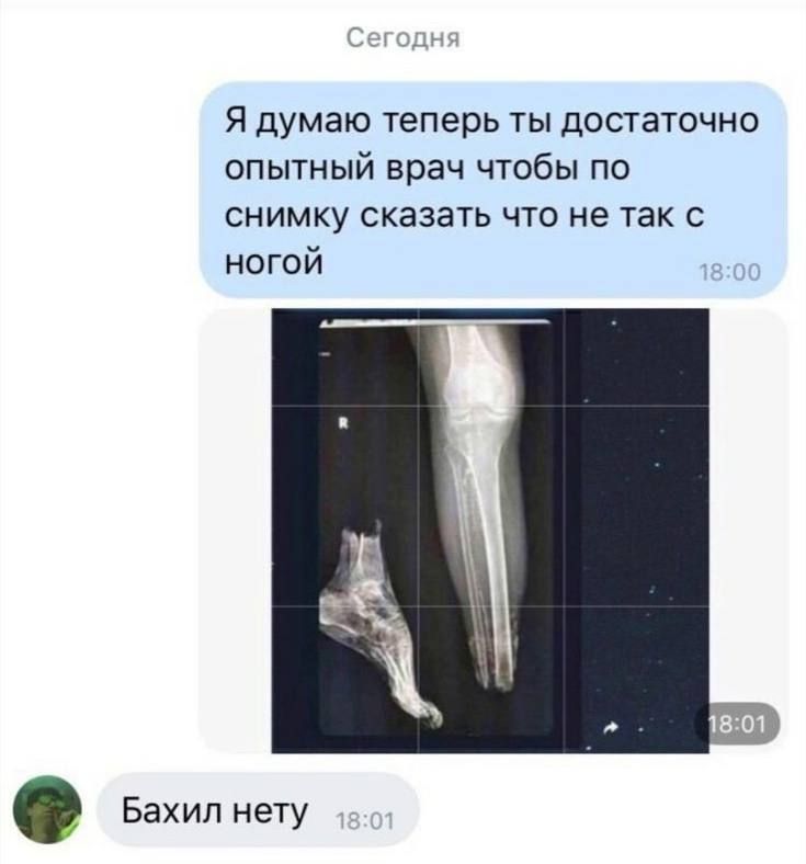 Сегодня
Я думаю теперь ты достаточно опытный врач чтобы по снимку сказать что не так с ногой
[изображение рентгенографического снимка]
Бахил нету