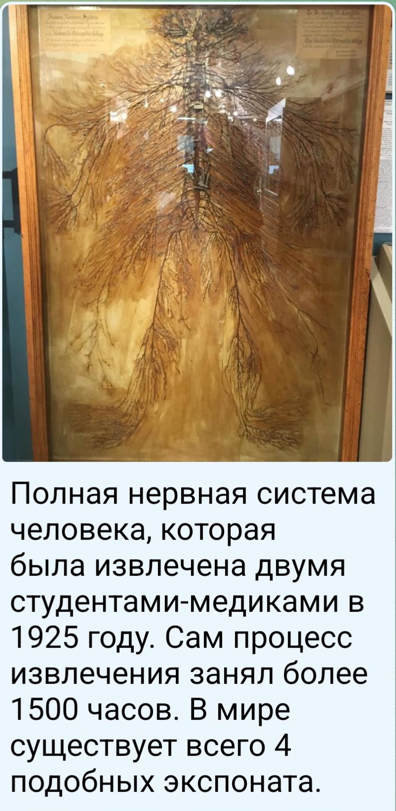 Полная нервная система человека, которая была извлечена двумя студентами-медиками в 1925 году. Сам процесс извлечения занял более 1500 часов. В мире существует всего 4 подобных экспоната.