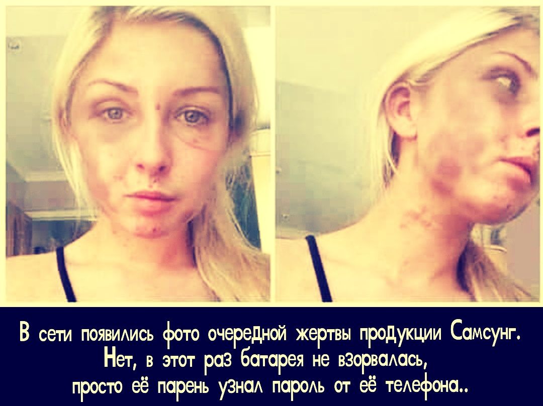 В сети появились фото очередной жертвы продукции Самсунг. Нет, в этот раз батарея не взорвалась, просто её парень узнал пароль от её телефона..
