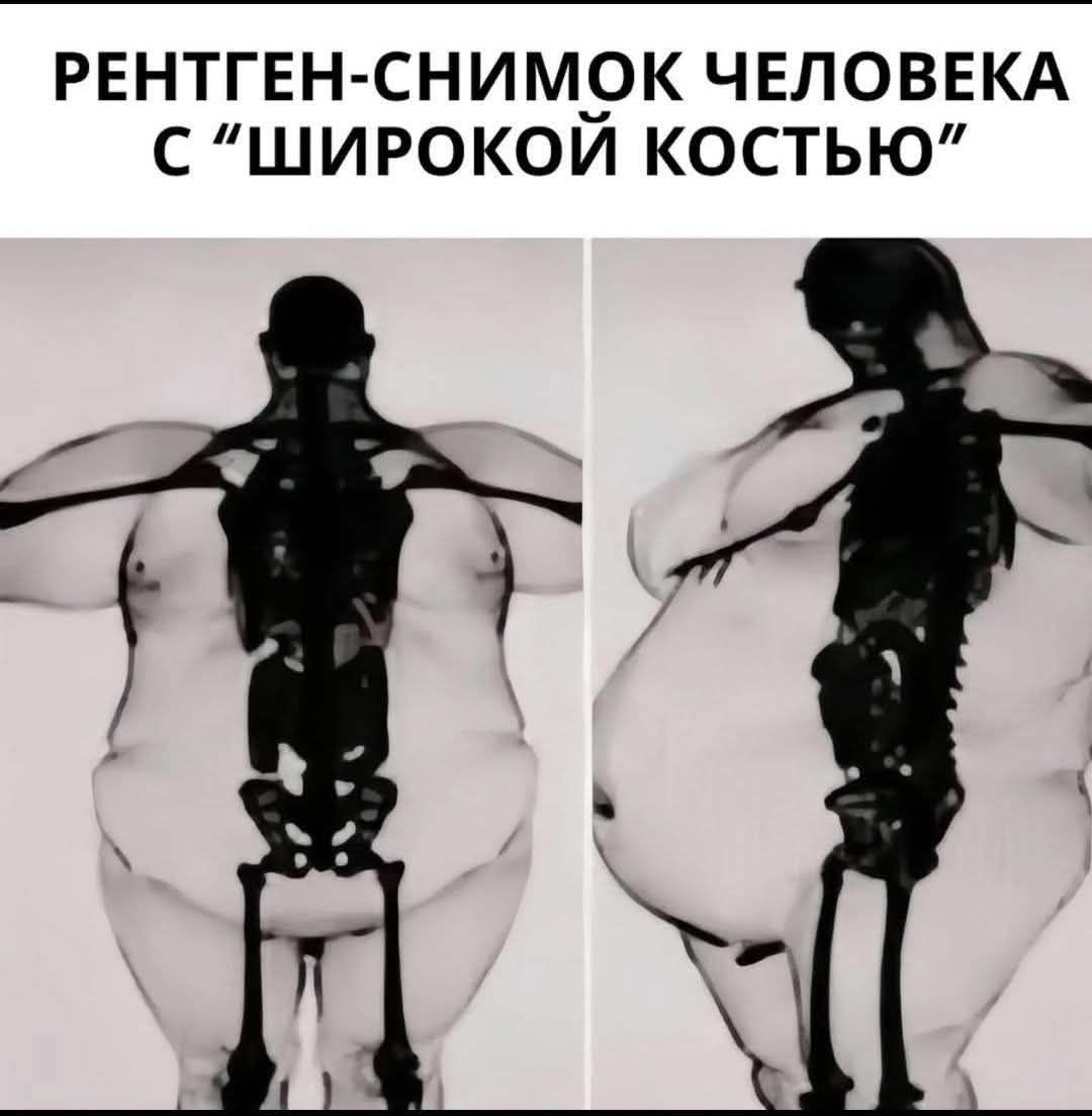 РЕНТГЕН-СНИМОК ЧЕЛОВЕКА С 