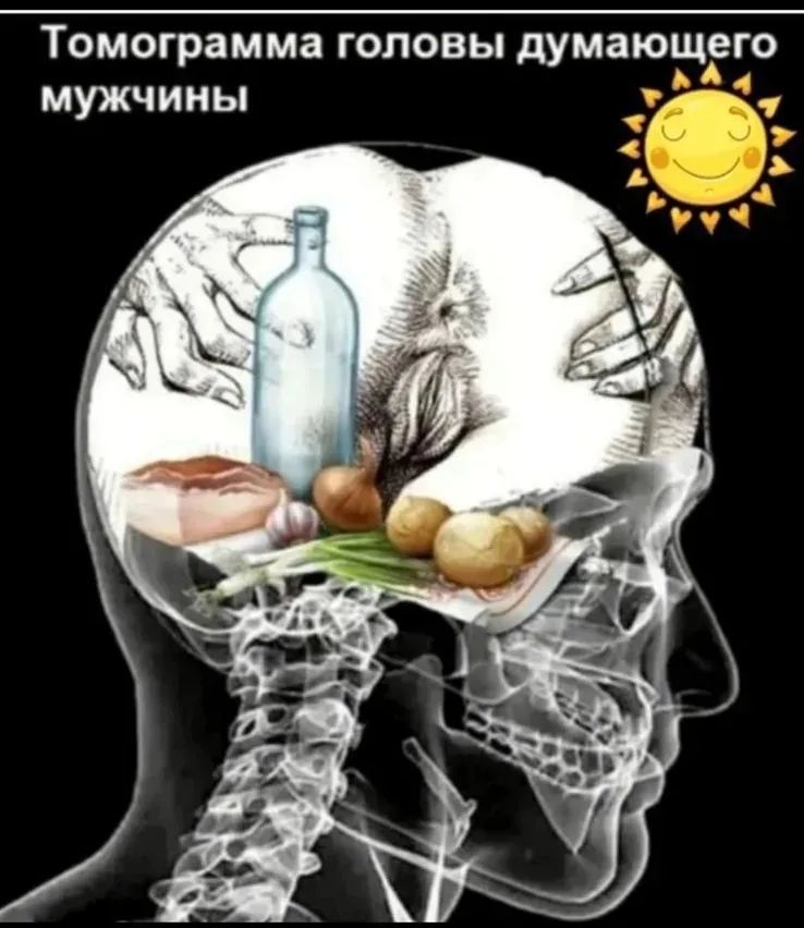 Томограмма головы думающего мужчины