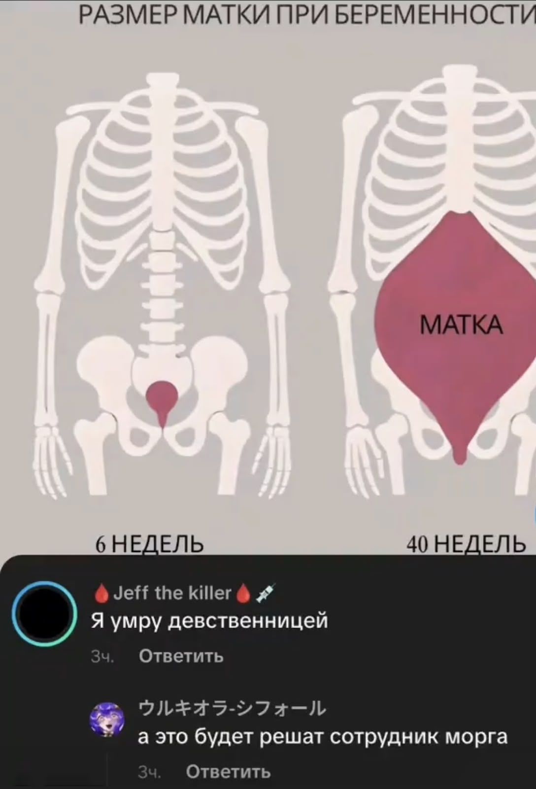 РАЗМЕР МАТКИ ПРИ БЕРЕМЕННОСТИ МАТКА 6 НЕДЕЛЬ 40 НЕДЕЛЬ Jeff the killer Я умру девственницей 3ч. Ответить УЛЬКИОРА-СИФОЛЛ а это будет решать сотрудник морга 3ч. Ответить