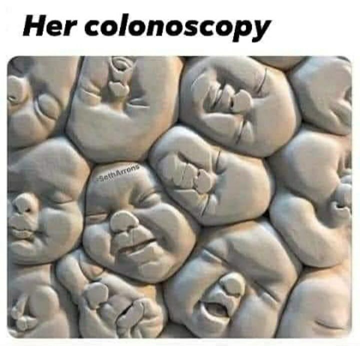 Her colonoscop