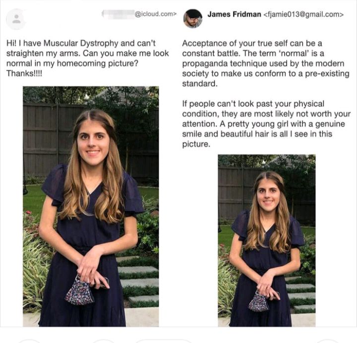 Hil have Muscular Dystrophy and cant straighten my arms Can you make me look normal in my homecoming picture Thank dcom James Fridman fjamie013gmailcom Acceptance of your true self can be a constant battle The term normal is a propaganda technique used by the modern society to make us conform to a pre existing standard If people cant look past your physical condition they are most likely not worth