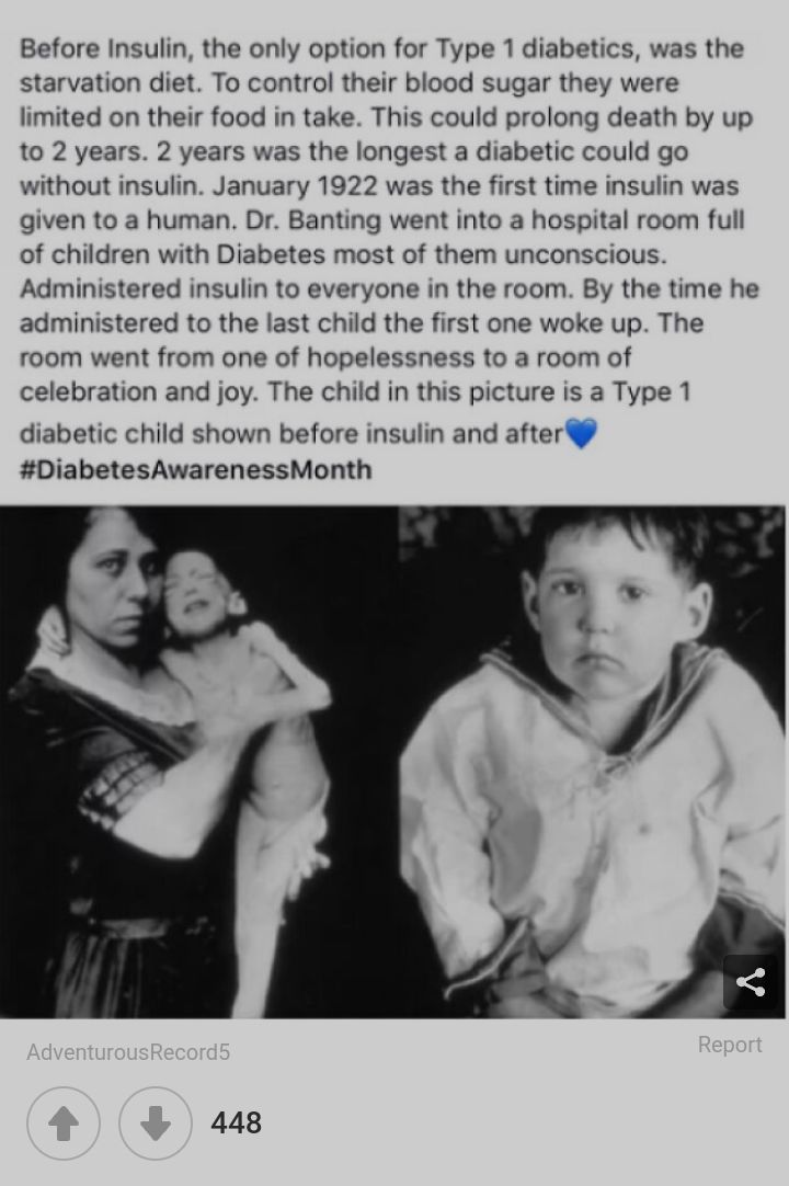 Before Insulin the only option for Type 1 diabetics was the starvation diet To control their blood sugar they were limited on their food in take This could prolong death by up to 2 years 2 years was the longest a diabetic could go without insulin January 1922 was the first time insulin was given to a human Dr Banting went into a hospital room full of children with Diabetes most of them unconscious