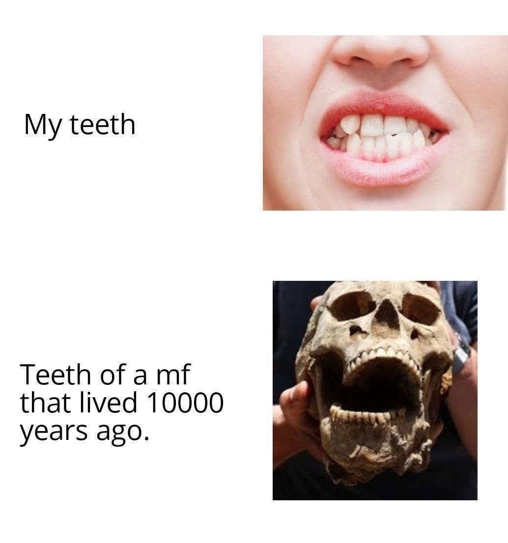 My teeth Teeth of a mf that lived 10000 years ago