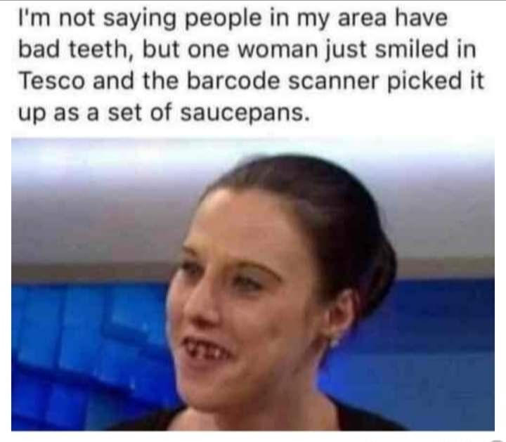 Im not saying people in my area have bad teeth but one woman just smiled in Tesco and the barcode scanner picked it up as a set of saucepans