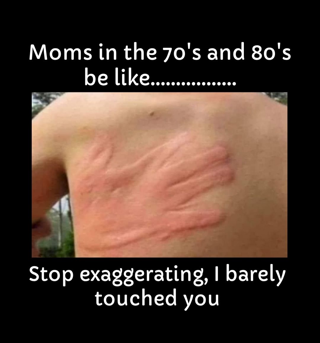 Moms in the 70s and 80s be like Stop exaggerating barely touched you