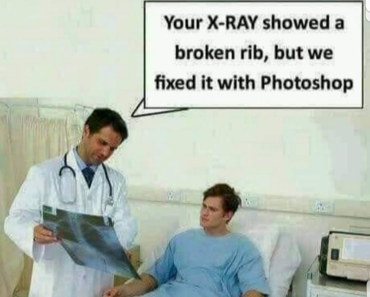 Your X RAY showed a broken rib but we fixed it with Photoshop