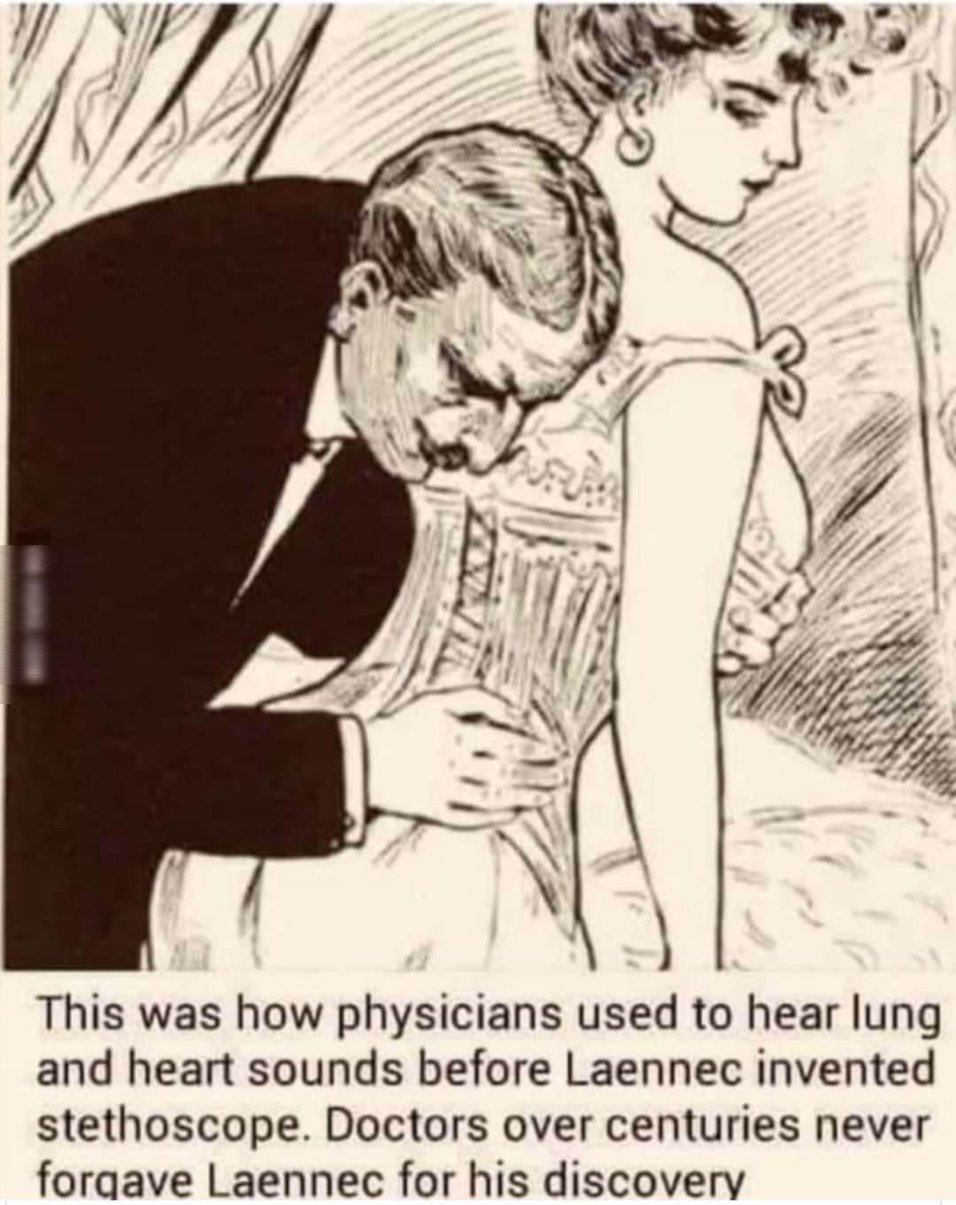 This was how physicians used to hear lung and heart sounds before Laennec invented stethoscope Doctors over centuries never foraave Laennec for his discovery