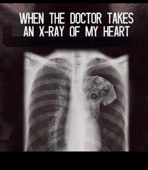 WHEN THE DOCTOR TAKES AN X RAY OF MY HEART