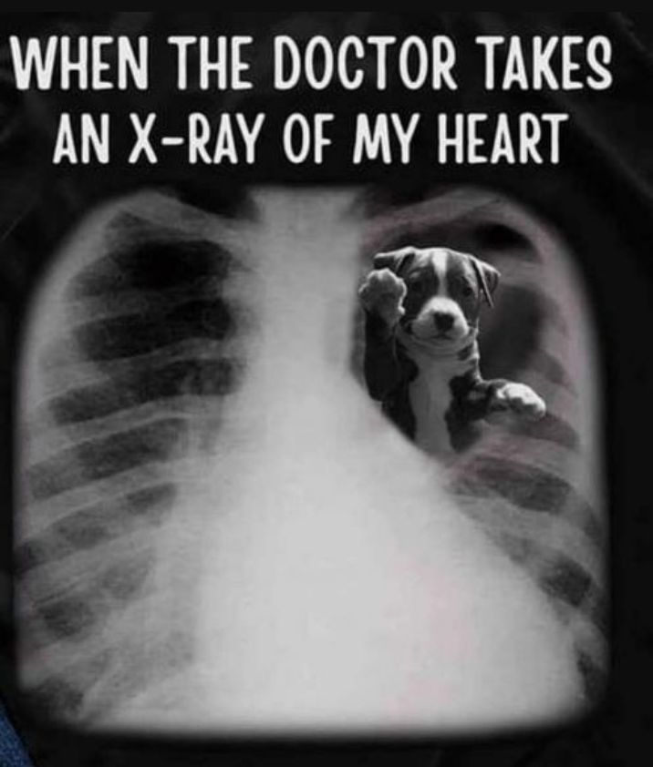 WHEN THE DOCTOR TAKES AN X RAY OF MY HEART