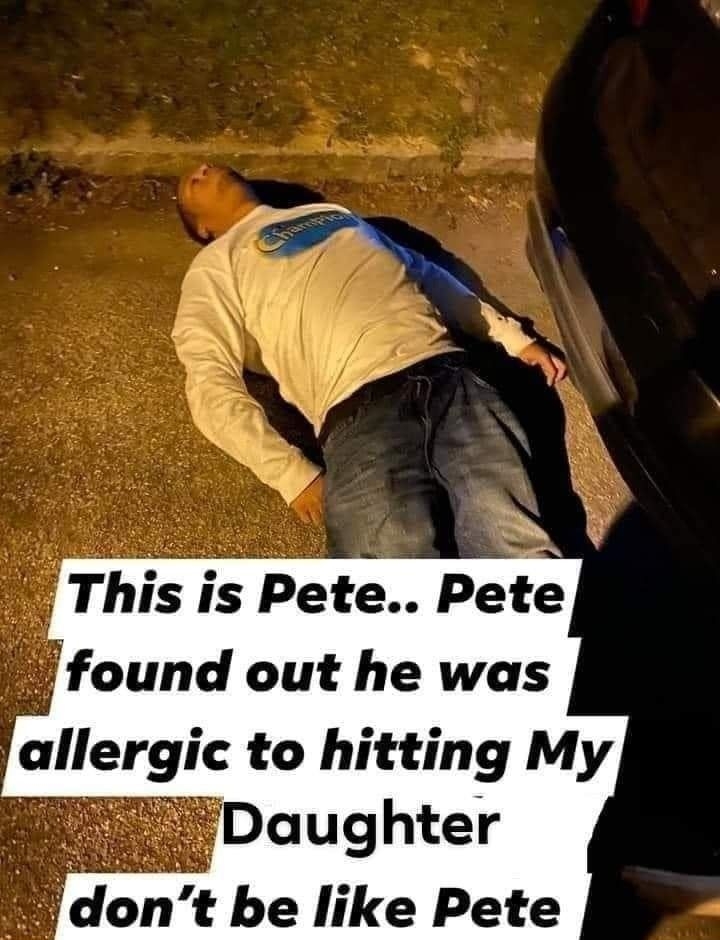 h This is Pete Pete found out he was allergic to hitting My dont be like Pete CocofFun