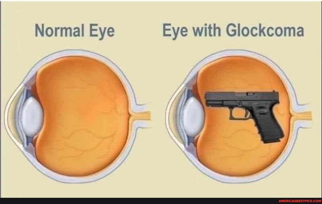 Normal Eye Eye with Glockcoma