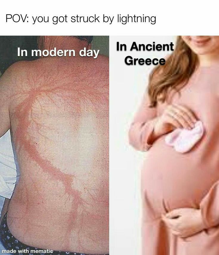 POV you got struck by lightning In modern day In Ancient Greec