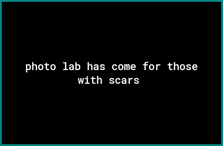 photo lab has come for those with scars