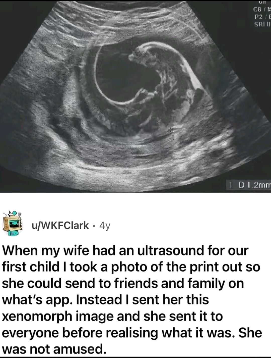 D1 2 uWKFClark 4y When my wife had an ultrasound for our first child took a photo of the print out so she could send to friends and family on whats app Instead sent her this xenomorph image and she sent it to everyone before realising what it was She was not amused